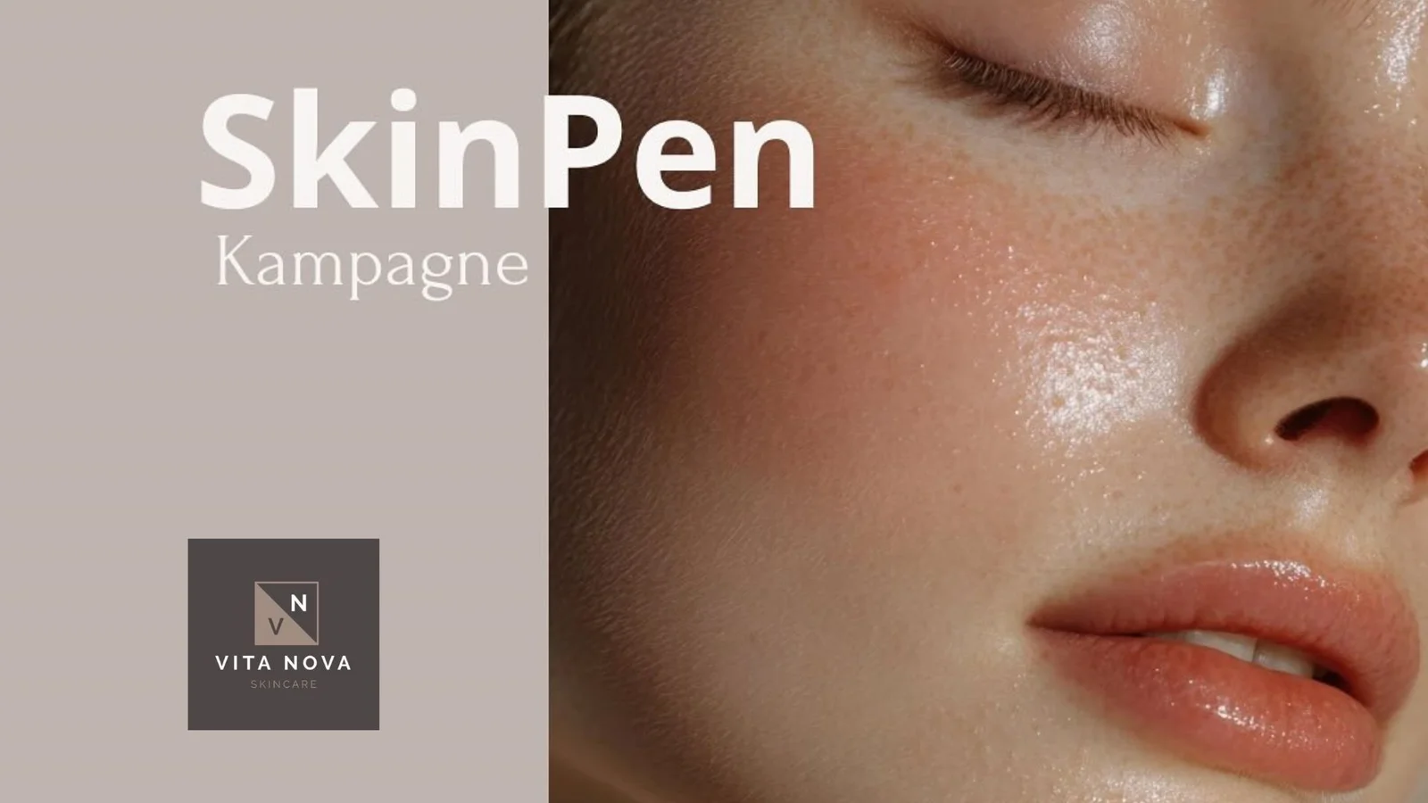 Tilbud på SkinPen-behandlinger hos Vita Nova Skincare