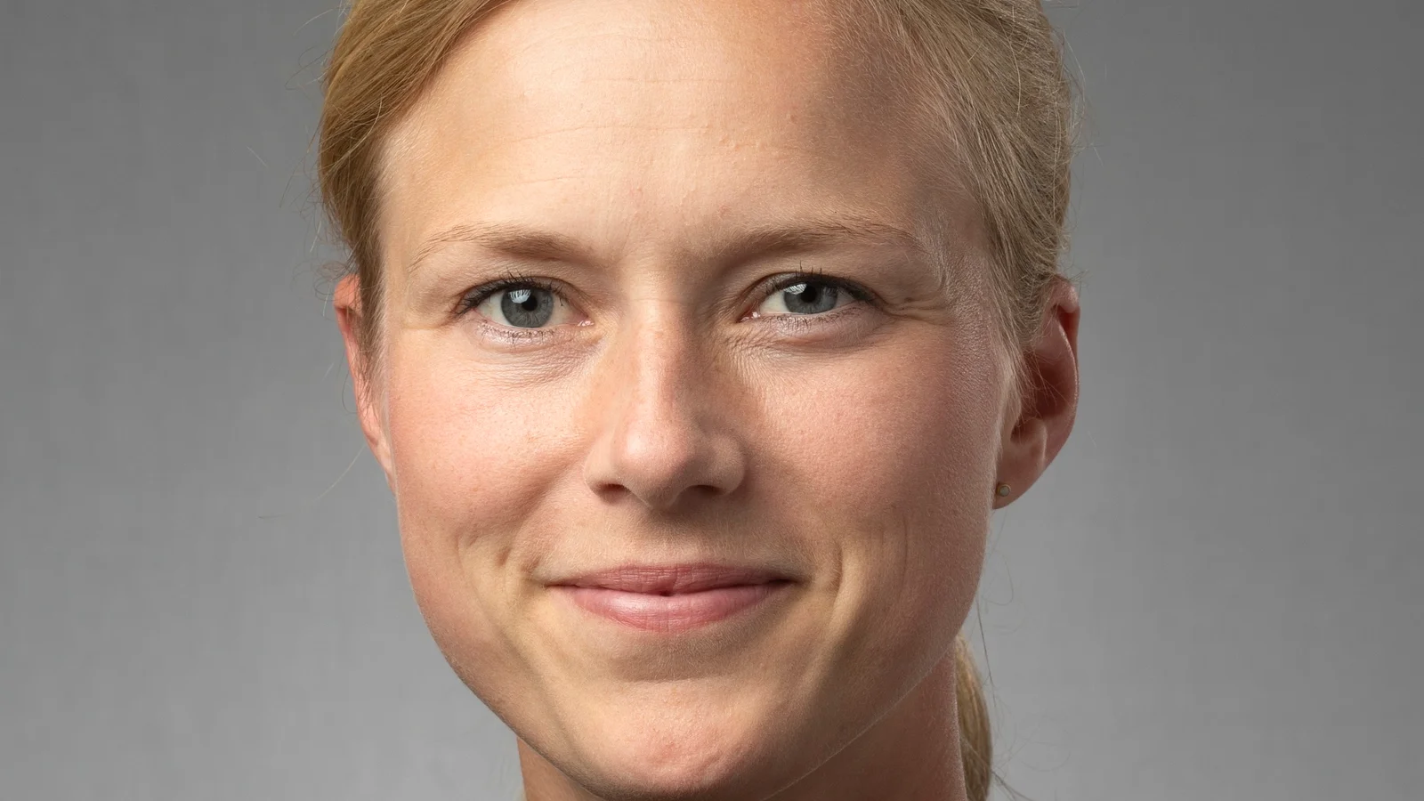 Kvinder med svangerskabsforgiftning risikerer kronisk nyresygdom