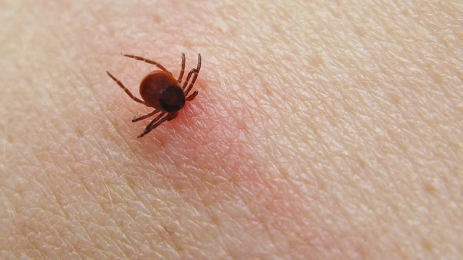 Anbefalingerne om TBE-vaccination er uændrede i flåtsæsonen
